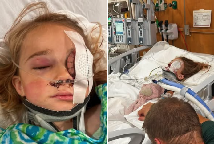 Pastor’s 6-year-old Daughter Loses Eye in Freak Lawn Mower Accident, Suffers Brain Injury