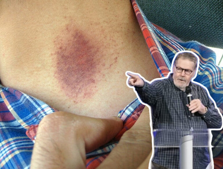 Prominent Charismatic Says Jesus Told Him To Give Another Man a ‘Hickey’- So He Did